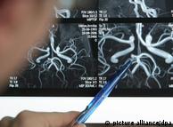 A doctor points a pen at a MRT scan