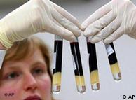 Científica alemana examina muestras de sangre.