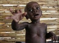 Niño desnutrido en Maradi, Níger.