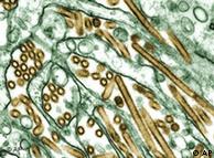 H5N1: habrá más virus temidos como la famosa gripe aviar.