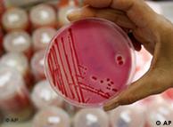 Bakteri Salmonella mengalami mutasi di ruang tanpa bobot
