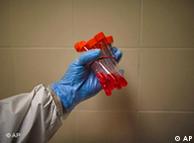 انفلونزا الخنازير ..فيروسات شرسة والوقاية بتطبيق قواعد النظافة العامة 0,,4225533_1,00