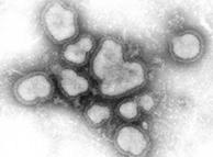 Вирус гриппа типа А в поле зрения электронного микроскопа
