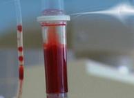 Οι μολύνσεις του αίματος είναι συνήθως μεγάλη απειλή για τους ασθενείς