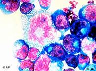 Células infectadas con el virus IH.