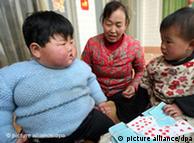 Pang Ya (left), 2 years old, plays poker with normal children at the same age next to her grandmother at home in Taocun town, Yuncheng city, northwest Chinas Shanxi province, 27 February 2010. Born at a normal weight, Pang Ya (pet name) now tips the scales at 41.5 kilograms, which is about as much as an adult Chinese woman. Pang Ya weighed around 4 kilograms when she was born in January 2008, but reached 20 kilograms in just 8 months, and ever since then she kept piling on the weight. Now her worried parents are seeking medical help. They admit the toddler has a very healthy appetite, but claim doctors have no idea what is wrong with their daughter. Pang Ya is just one of over 60 million obese people in China. The numbers doubled between 1992 and 2002. Photo: Imaginechina/Xue Jun Sx 