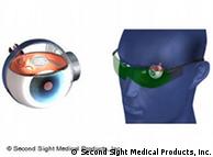 Computerized graphic shows model of eye with Argus II implant and robot