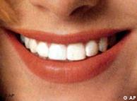 وسيلة جديدة لمعالجة تسوس الاسنان 0,,679803_1,00