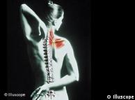 Причината за болките в гърба често се крие в  мускулите